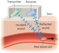 A Doppler flow meter measures the speed of red blood cells.